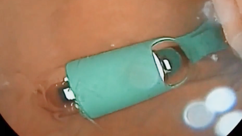 自走式カプセル内視鏡